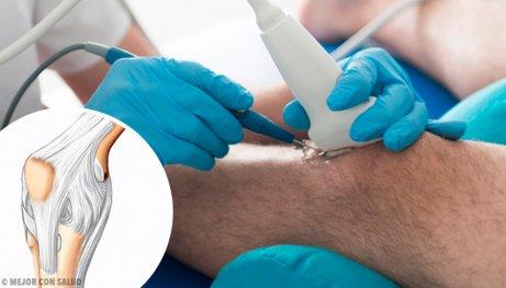 d981d988d8a7d8a6d8af-d8aad986d8b8d98ad8b1-d8a7d984d8b1d983d8a8d8a9 فوائد تنظير الركبة