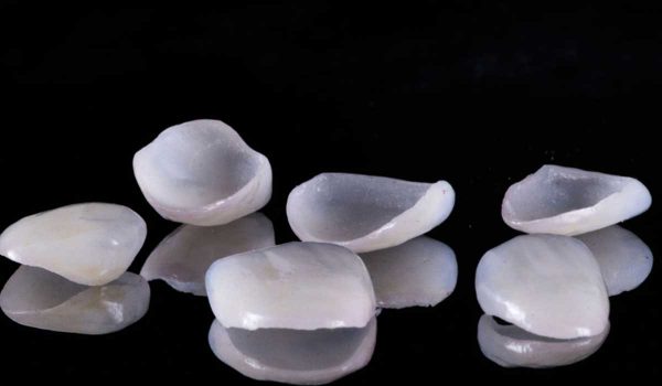 فينير الاسنان أو اسنان بورسلين