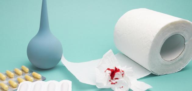 كيفية علاج البواسير بالاعشاب