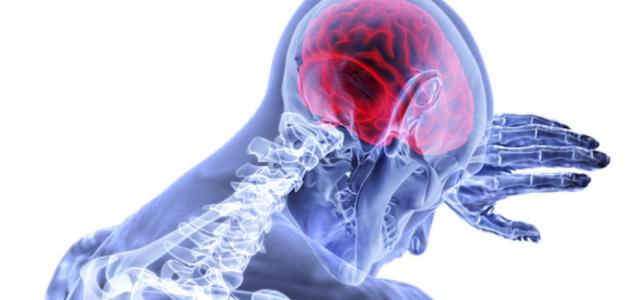 ما اعراض مرض السرطان في الراس