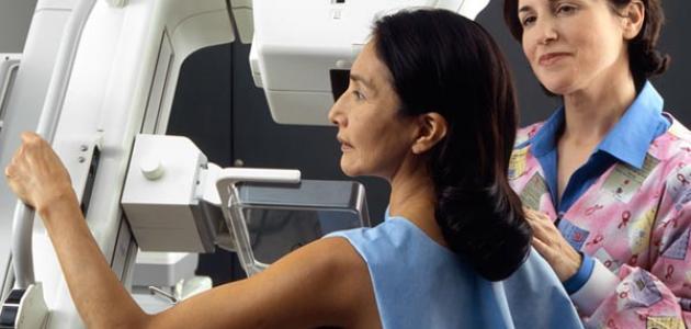 ما هو سرطان الثدي