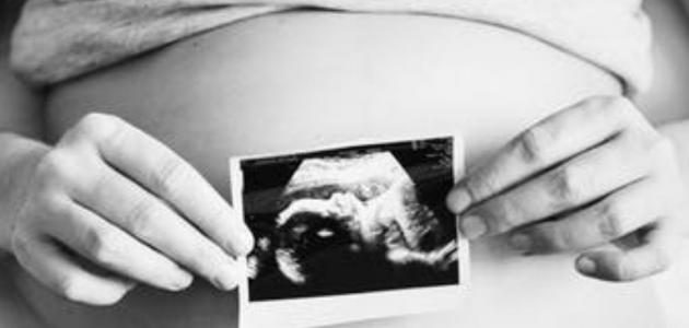 ما هو علاج توقف نبض الجنين