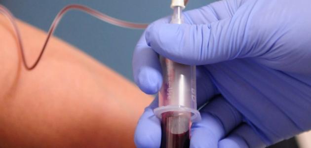 ماذا يعني ارتفاع هرمون tsh