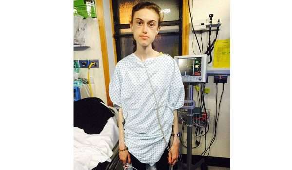 مرض فقدان الشهية