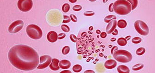 مرض لوكيميا