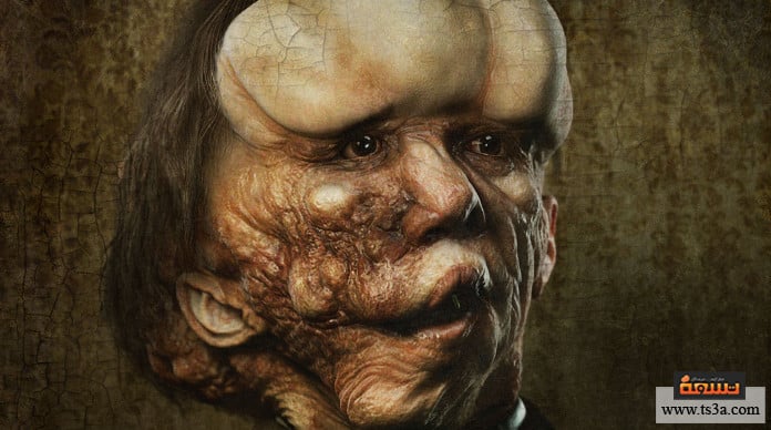 مسوخ السيرك جوزيف ميريك