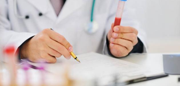 معدل هرمون الذكورة الطبيعي