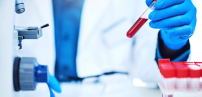 df77f02a5c2aea8f87b6be3cedb82507-1 الفرق بين مخزون الحديد والحديد