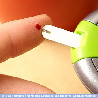 ضعوا قطرة الدم على الشريحة ضعوا قطرة الدم على الشريحة