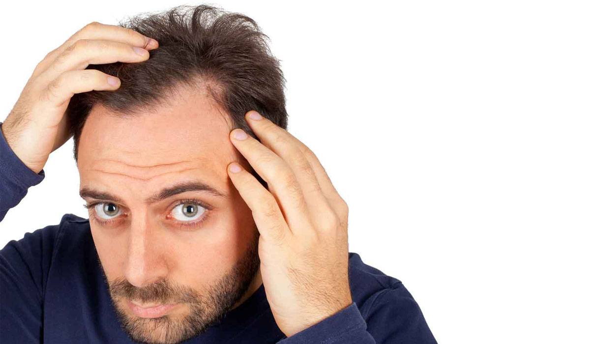 زراعة الشعر بالشريحة