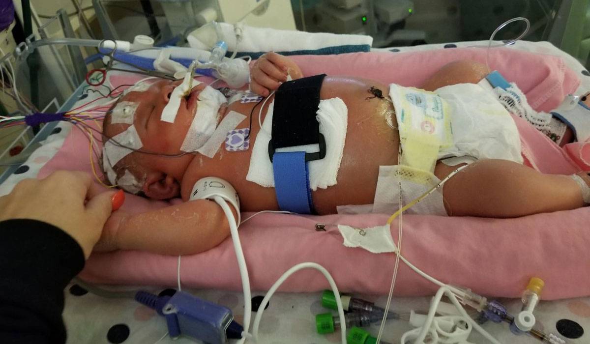 التهاب السحايا