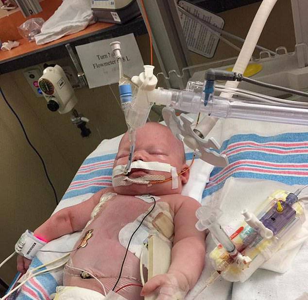 الهربس عند الرضع