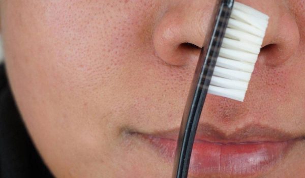 علاج الرؤوس السوداء بمعجون الاسنان