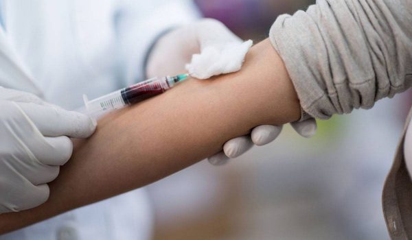 e-36-4 اعراض مرض الايدز عند النساء