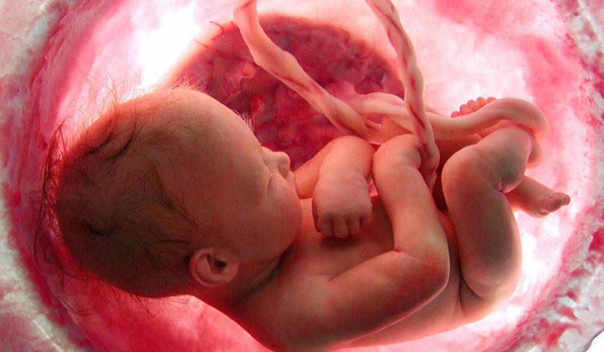 السائل الامينوسي