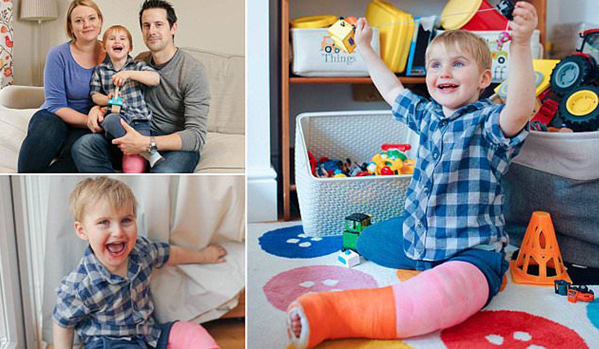 e-72-2 مرض وراثي