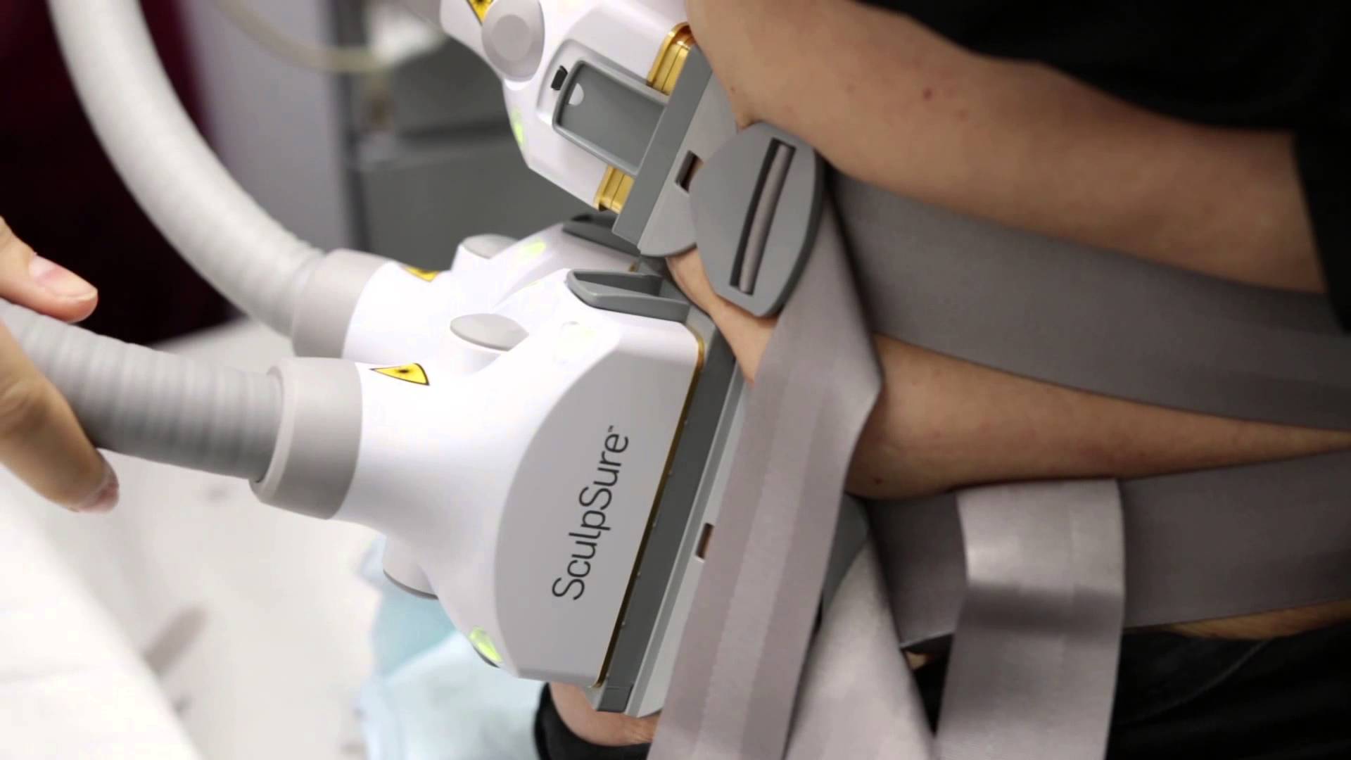 e-86-3 جهاز sculpsure