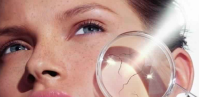 e8d6d83504cc1108f6787e4b606659b4-1 علاج حروق الشمس طبيعيا