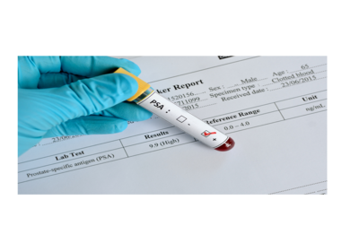 ea9f750517f23633bdd7a83d0878cc82-1 بعض الحقائق عن سرطان البروستات