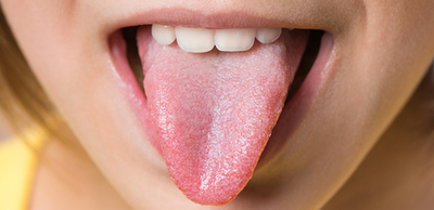 eedce5a605ebdb0060a79cb163eec22d-1 يبوسة اللسان