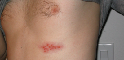 f0d1f242045f3d0b7b4746795242005c-1 الحزام الناري والتغذية