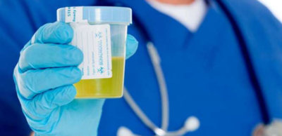 f8619f4a3c624b4d1b581e3911a0dc41-1 تحليل البول للمخدرات