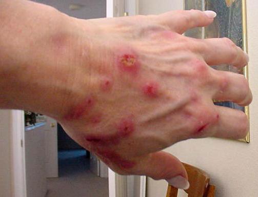 fdsafa-temu-bolezni-margelonov_2