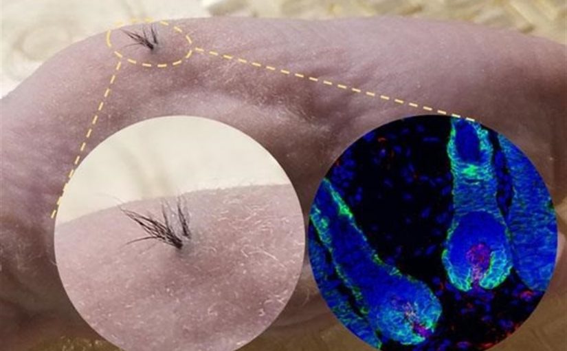 foliculos-capilares-funcionais-celulas-tronco-825x510-2 زراعة الشعر بالخلايا الجذعية في دبي لندن كلينك