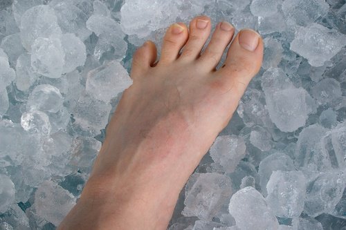 foot-ice الثلج لمعالجة تورم إبهام القدم