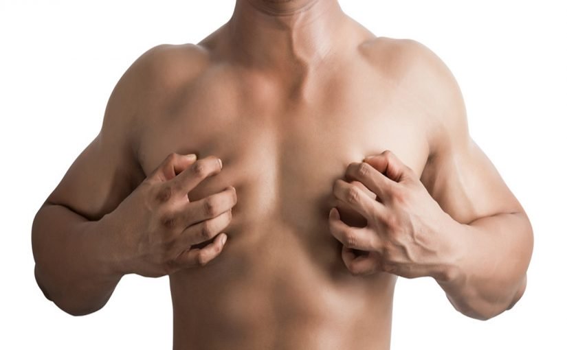 gynecomastia-2-825x510-2 التثدي