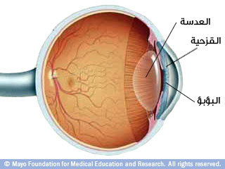 الساد ومشاكل نظر أخرى متعلقة بتقدم السن الساد ومشاكل نظر أخرى متعلقة بتقدم السن