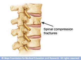 زرق العين زرق العين