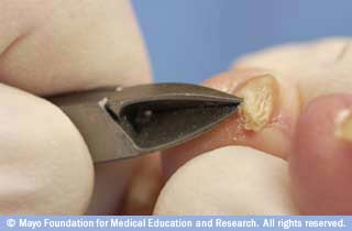 انزع مقاطع صغيرة انزع مقاطع صغيرة