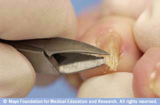 قم بالقطع على التوالي قم بالقطع على التوالي