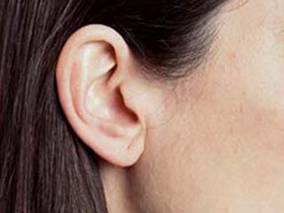 عجيبة سمعية عجيبة سمعية