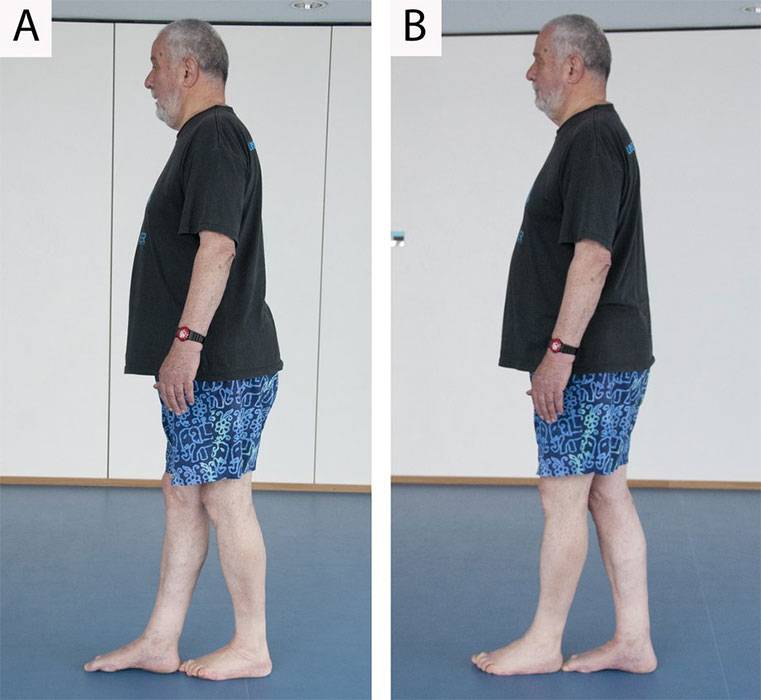 heel-to-toe-walk Heel-to-toe walk