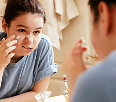 how_to_treat_acne-7-380x335-1 معالجة حب الشباب :