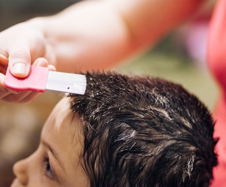 اعراض القمل