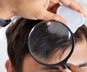 الوقاية من القمل