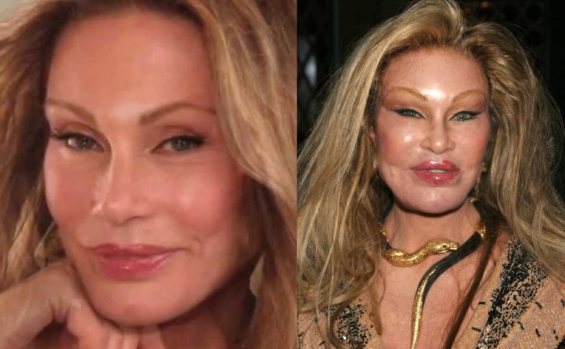 jocelyn-wildenstein-1024x729-825x510-2 مخاطر عمليات التجميل