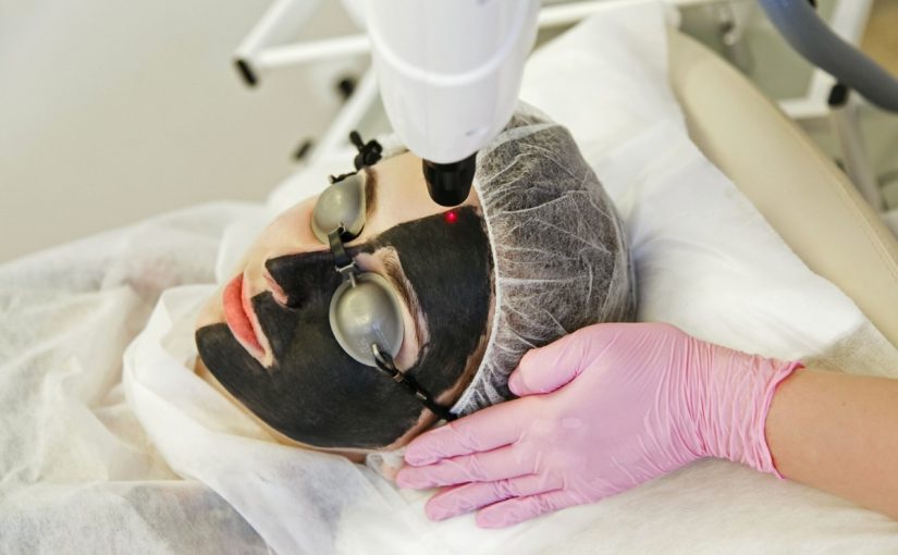 فوائد الليزر الكربوني