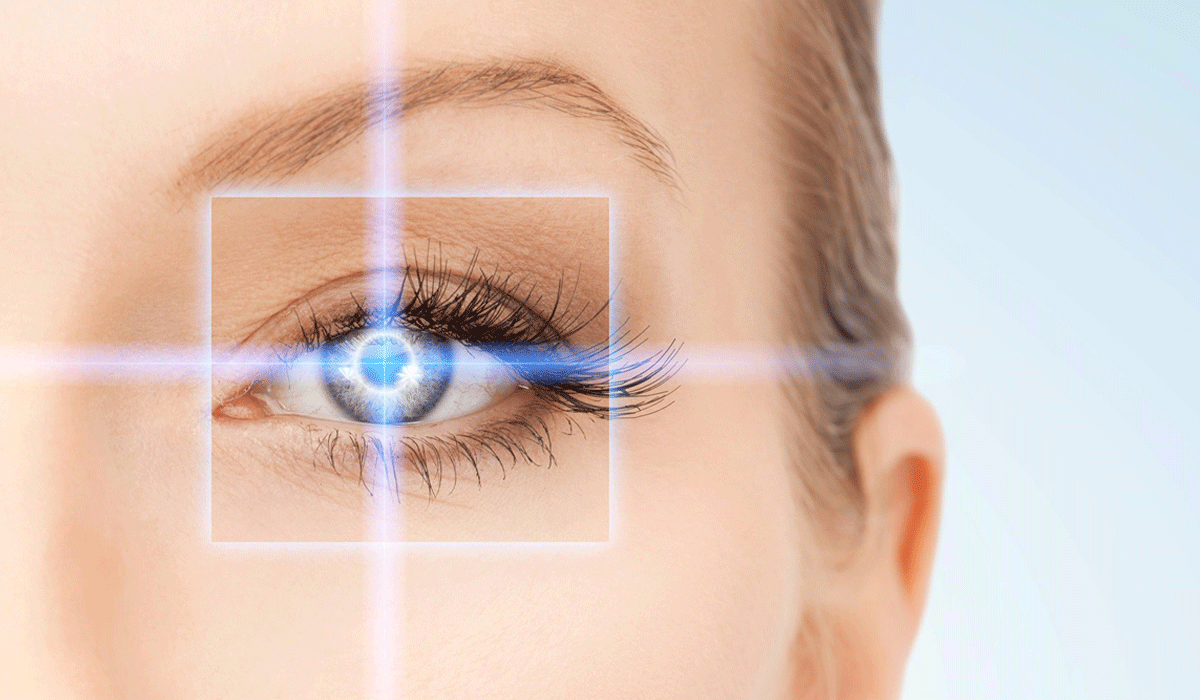 عملية تغيير لون العين