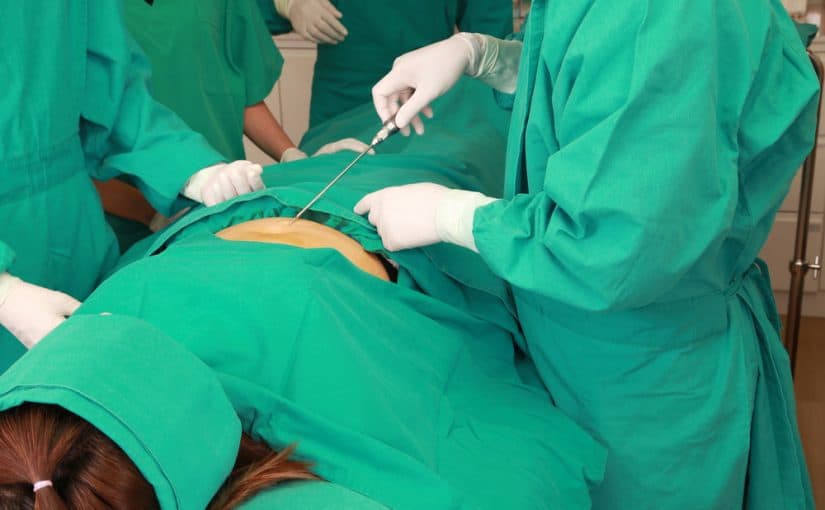 liposuction-cannula-825x510-2 شفط دهون البطن