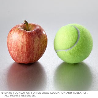 الفواكه: التفاح وغيره الفواكه: التفاح وغيره