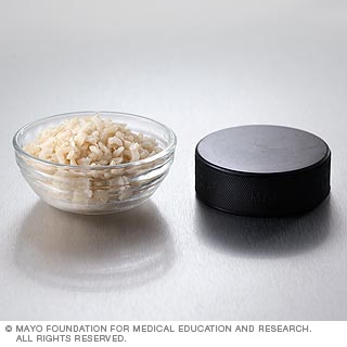 كربوهيدرات: الأرز البني وغيره كربوهيدرات: الأرز البني وغيره