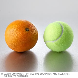 الفواكه: البرتقال الفواكه: البرتقال