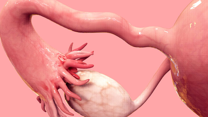 ovary-1-2 طبابة نت - استئصال المبيض