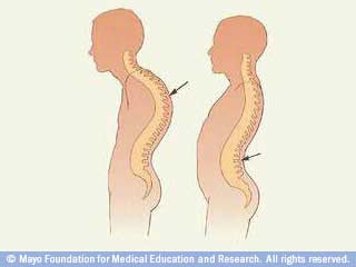 ابق أكتافك منتصبة ابق أكتافك منتصبة