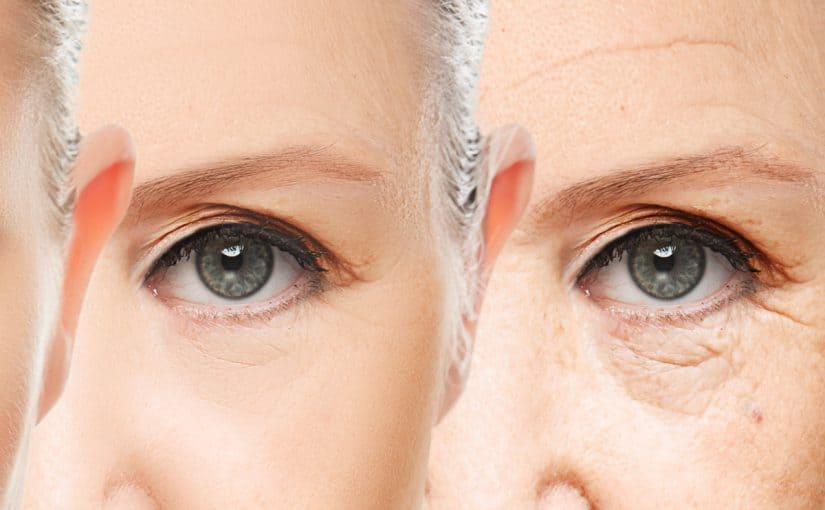 que-es-la-blefaroplastia-825x510-2 جهاز الهايفو