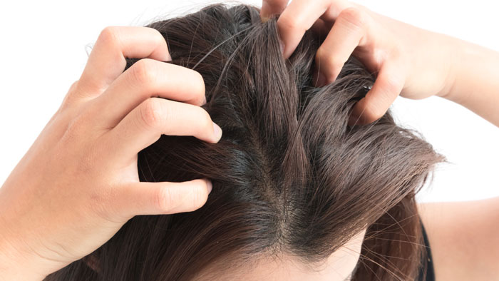 scalp-diseases-2 طبابة نت - الحالات المرضية التي تصيب فروة الرأس